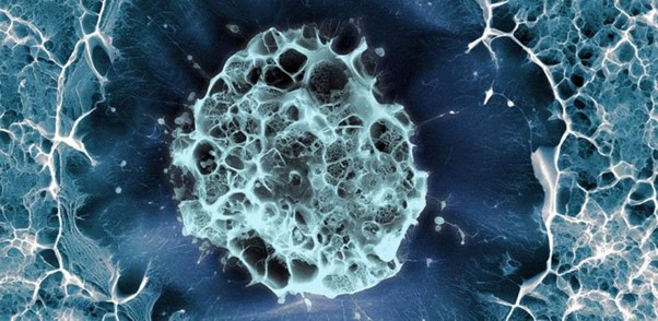 1735535208-1733766408-Stem_Cell_Implant